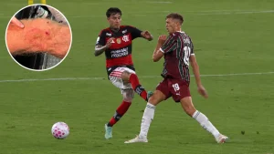 Fluminense cuestiona la amarilla a Erick Pulgar y acusa silencio del VAR
